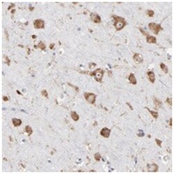 RPL3 Rabbit anti-Human, Polyclonal Antibody, Abnova 100 &mu;L | Buy Online | Abnova Corporation | Fisher Scientific