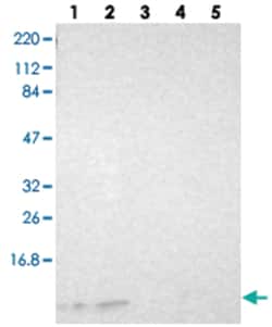 RPS21, Rabbit, Polyclonal Antibody, Abnova 100&mu;L; Unlabeled:Antibodies,