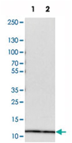 RPS21, Rabbit, Polyclonal Antibody, Abnova 100&mu;L; Unlabeled:Antibodies,