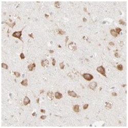 RPS21, Rabbit, Polyclonal Antibody, Abnova 100&mu;L; Unlabeled:Antibodies,