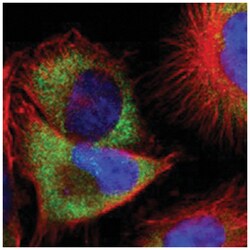 RPS21, Rabbit, Polyclonal Antibody, Abnova 100&mu;L; Unlabeled:Antibodies,