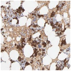SPTB Rabbit anti-Human, Polyclonal Antibody, Abnova 100 &mu;L | Buy Online | Abnova Corporation | Fisher Scientific