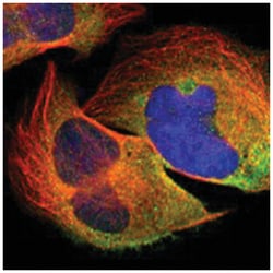 SPTB Rabbit anti-Human, Polyclonal Antibody, Abnova 100 &mu;L | Buy Online | Abnova Corporation | Fisher Scientific