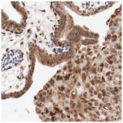 RPL12 Rabbit anti-Human, Polyclonal Antibody, Abnova 100&mu;L; Unlabeled:Antibodies,