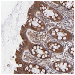 IVNS1ABP Rabbit anti-Human, Polyclonal Antibody, Abnova 100&mu;L; Unlabeled:Antibodies,