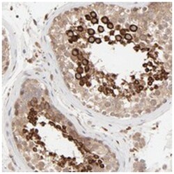 RAB5C, Rabbit, Polyclonal Antibody, Abnova 100&mu;L; Unlabeled:Antibodies,