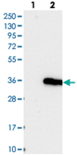 IFT43, Rabbit, Polyclonal Antibody, Abnova 100 &mu;L | Buy Online | Abnova Corporation | Fisher Scientific