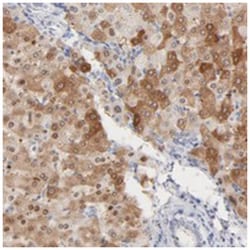 ONECUT1, Rabbit, Polyclonal Antibody, Abnova 100&mu;L; Unlabeled:Antibodies,