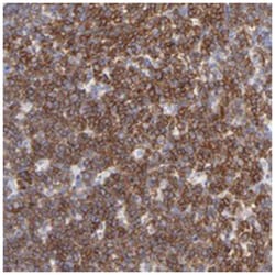 LAT2 Rabbit anti-Human, Polyclonal Antibody, Abnova 100&mu;L; Unlabeled:Antibodies,