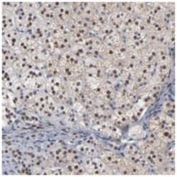 FOXN2, Rabbit, Polyclonal Antibody, Abnova 100&mu;L; Unlabeled:Antibodies,