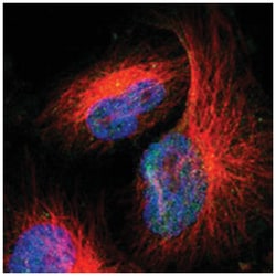 FOXN2, Rabbit, Polyclonal Antibody, Abnova 100&mu;L; Unlabeled:Antibodies,