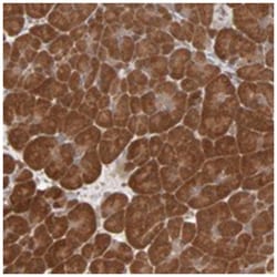 SCFD1, Rabbit, Polyclonal Antibody, Abnova 100&mu;L; Unlabeled:Antibodies,