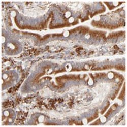 PARP12, Rabbit, Polyclonal Antibody, Abnova 100&mu;L; Unlabeled:Antibodies,