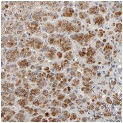 C14orf119, Rabbit, Polyclonal Antibody, Abnova 100&mu;L; Unlabeled:Antibodies,