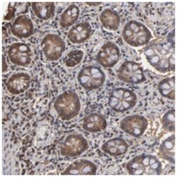 PNPLA4, Rabbit, Polyclonal Antibody, Abnova 100&mu;L; Unlabeled:Antibodies,