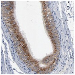 YIPF6, Rabbit, Polyclonal Antibody, Abnova 100 &mu;L | Buy Online | Abnova Corporation | Fisher Scientific