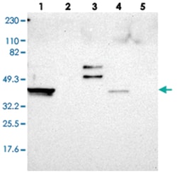 ERICH1, Rabbit, Polyclonal Antibody, Abnova 100 &mu;L | Buy Online | Abnova Corporation | Fisher Scientific