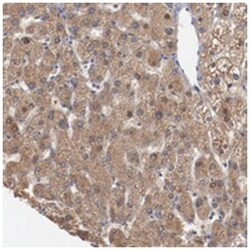 ERICH1, Rabbit, Polyclonal Antibody, Abnova 100 &mu;L | Buy Online | Abnova Corporation | Fisher Scientific