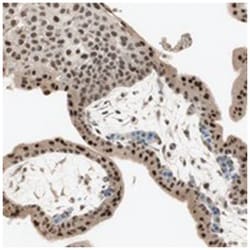 RNGTT, Rabbit, Polyclonal Antibody, Abnova 100&mu;L; Unlabeled:Antibodies,