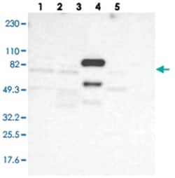 F13B, Rabbit, Polyclonal Antibody, Abnova 100&mu;L; Unlabeled:Antibodies,