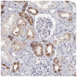 F13B, Rabbit, Polyclonal Antibody, Abnova 100&mu;L; Unlabeled:Antibodies,