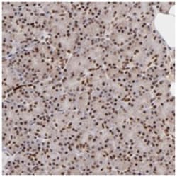 ZFX Rabbit anti-Human, Polyclonal Antibody, Abnova 100 &mu;L | Buy Online | Abnova Corporation | Fisher Scientific