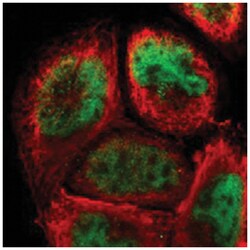 ZFX Rabbit anti-Human, Polyclonal Antibody, Abnova 100 &mu;L | Buy Online | Abnova Corporation | Fisher Scientific