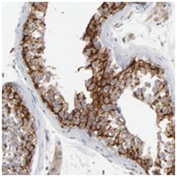 ITPR3 Rabbit anti-Human, Polyclonal Antibody, Abnova 100 &mu;L | Buy Online | Abnova Corporation | Fisher Scientific