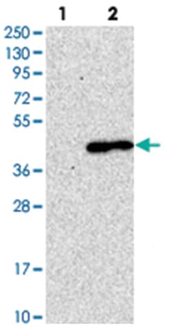 LMAN2, Rabbit, Polyclonal Antibody, Abnova 100&mu;L; Unlabeled:Antibodies,