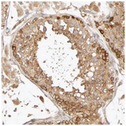 SGSM1 Rabbit anti-Human, Polyclonal Antibody, Abnova 100 &mu;L | Buy Online | Abnova Corporation | Fisher Scientific