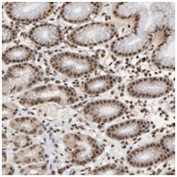 ZNF384, Rabbit, Polyclonal Antibody, Abnova 100 &mu;L | Buy Online | Abnova Corporation | Fisher Scientific