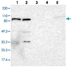 GIT1 Rabbit anti-Human, Polyclonal Antibody, Abnova 100 &mu;L | Buy Online | Abnova Corporation | Fisher Scientific