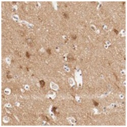 GIT1 Rabbit anti-Human, Polyclonal Antibody, Abnova 100 &mu;L | Buy Online | Abnova Corporation | Fisher Scientific