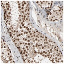 SMARCD1, Rabbit, Polyclonal Antibody, Abnova 100&mu;L; Unlabeled:Antibodies,