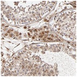 DNAAF2 Rabbit anti-Human, Polyclonal Antibody, Abnova 100&mu;L; Unlabeled:Antibodies,