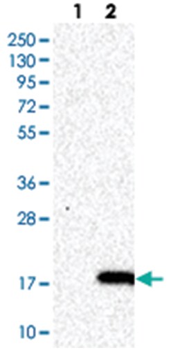 ROBLD3, Rabbit, Polyclonal Antibody, Abnova 100&mu;L; Unlabeled:Antibodies,