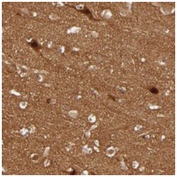 SDCCAG1 Rabbit anti-Human, Polyclonal Antibody, Abnova 100&mu;L; Unlabeled:Antibodies,