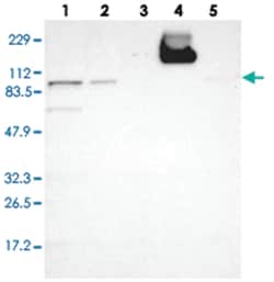 GIT1 Rabbit anti-Human, Polyclonal Antibody, Abnova 100&mu;L; Unlabeled:Antibodies,