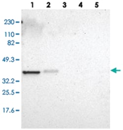 ARPC1A, Rabbit, Polyclonal Antibody, Abnova 100&mu;L; Unlabeled:Antibodies,