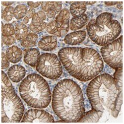 ARPC1A, Rabbit, Polyclonal Antibody, Abnova 100&mu;L; Unlabeled:Antibodies,