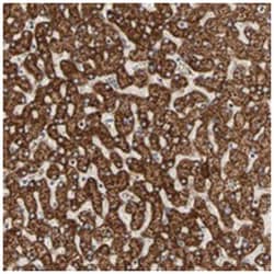 ARSD, Rabbit, Polyclonal Antibody, Abnova 100 &mu;L | Buy Online | Abnova Corporation | Fisher Scientific