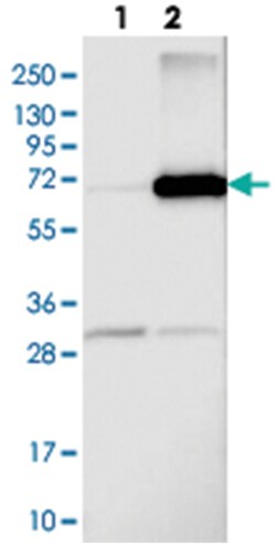 ARSD, Rabbit, Polyclonal Antibody, Abnova 100 &mu;L | Buy Online | Abnova Corporation | Fisher Scientific