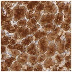 SCAP, Rabbit, Polyclonal Antibody, Abnova 100&mu;L; Unlabeled:Antibodies,