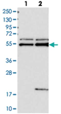 CXorf61, Rabbit, Polyclonal Antibody, Abnova 100&mu;L; Unlabeled:Antibodies,