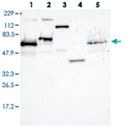 ETV3, Rabbit, Polyclonal Antibody, Abnova 100&mu;L; Unlabeled:Antibodies,