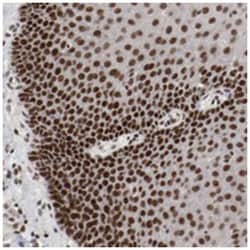 ETV3, Rabbit, Polyclonal Antibody, Abnova 100&mu;L; Unlabeled:Antibodies,