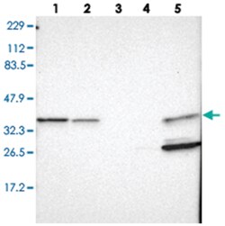 ARPC1B, Rabbit, Polyclonal Antibody, Abnova 100&mu;L; Unlabeled:Antibodies,
