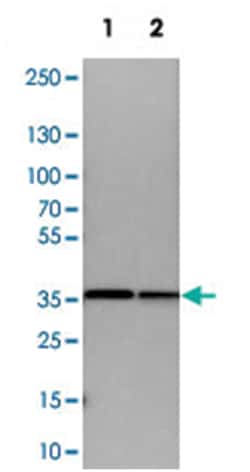 ARPC1B, Rabbit, Polyclonal Antibody, Abnova 100&mu;L; Unlabeled:Antibodies,