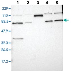 HRC, Rabbit, Polyclonal Antibody, Abnova 100&mu;L; Unlabeled:Antibodies,