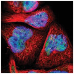 MYEF2, Rabbit, Polyclonal Antibody, Abnova 100&mu;L; Unlabeled:Antibodies,